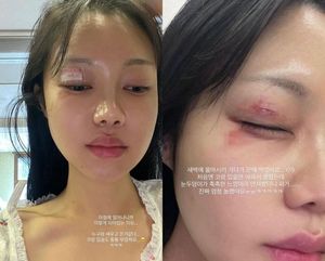 네이버SEO