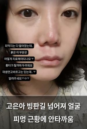 검색엔진최적화
